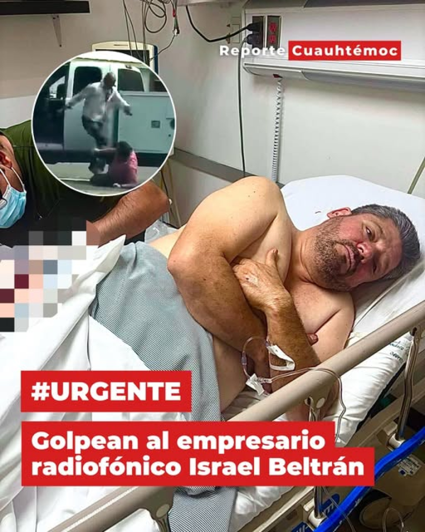 Golpean brutalmente a Israel Beltrán, de la Radio de Ojinaga